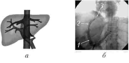 '   