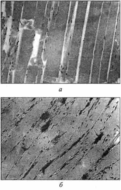 ̳ ,    Yersinia enterocolitica.    ,  7