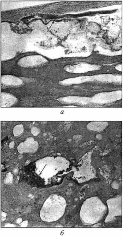 ̳  ,    Yersinia enterocolitica.    ,  7
