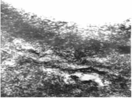  , 14-   