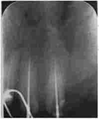 ³.  ., 67 , 