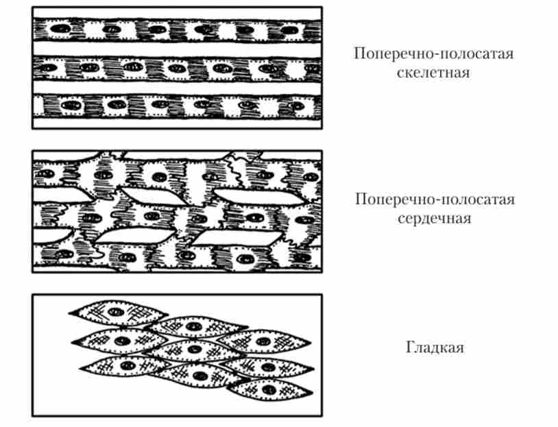 ' 